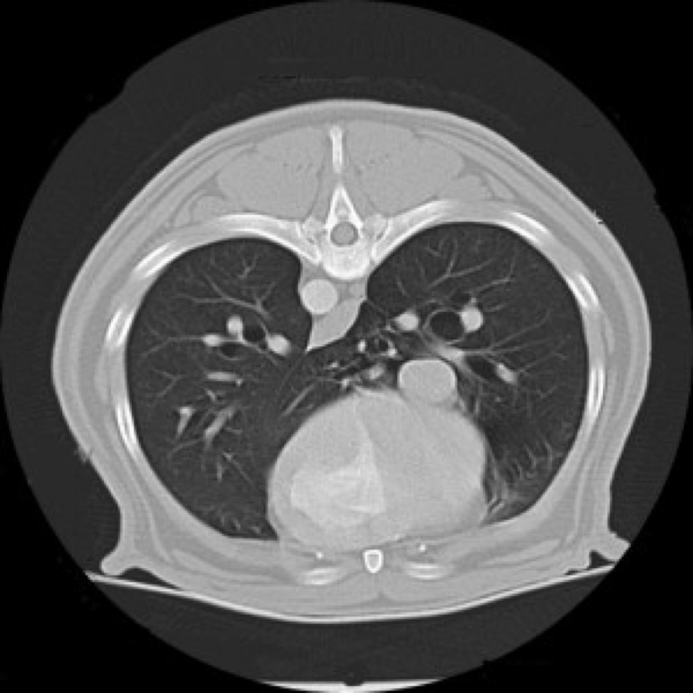 A CT cross-section through a dog’s chest showing both lung fields, the heart and the spine